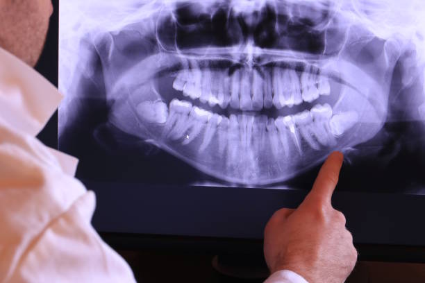 Best Urgent Tooth Repair  in Checotah, OK